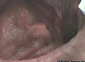 Way-out anal and pussy prolapse after bizarre dp